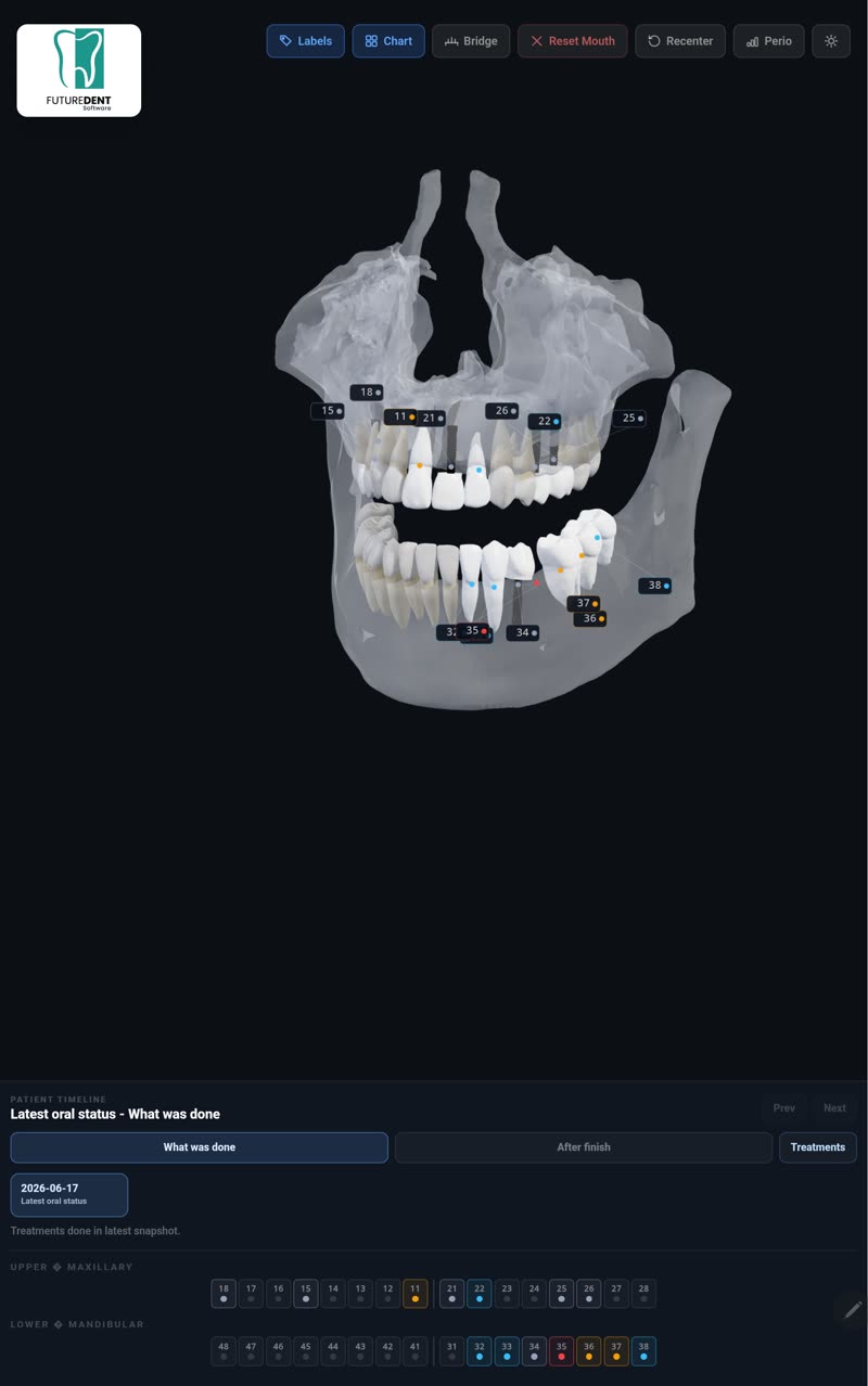 Ilustrim 3D i trajtimit dentar në aplikacionin Real 3D Illustration të Doktor.al