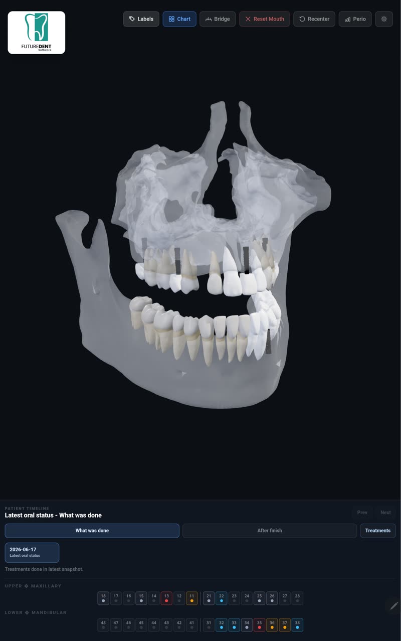 Prezantim vizual i planit të trajtimit dentar me ilustrime 3D